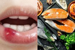 Xăm môi kiêng hải sản bao lâu?
