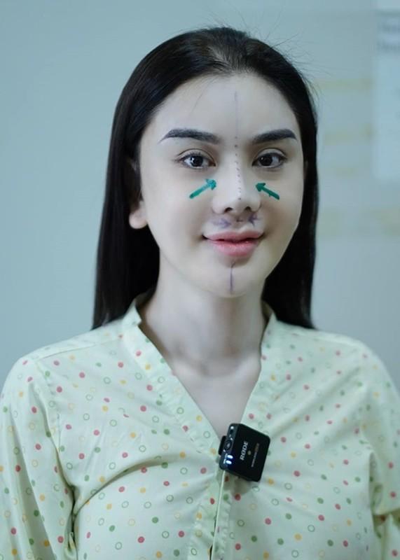 Khó nhận ra Lâm Khánh Chi sau màn dao kéo mới nhất-2