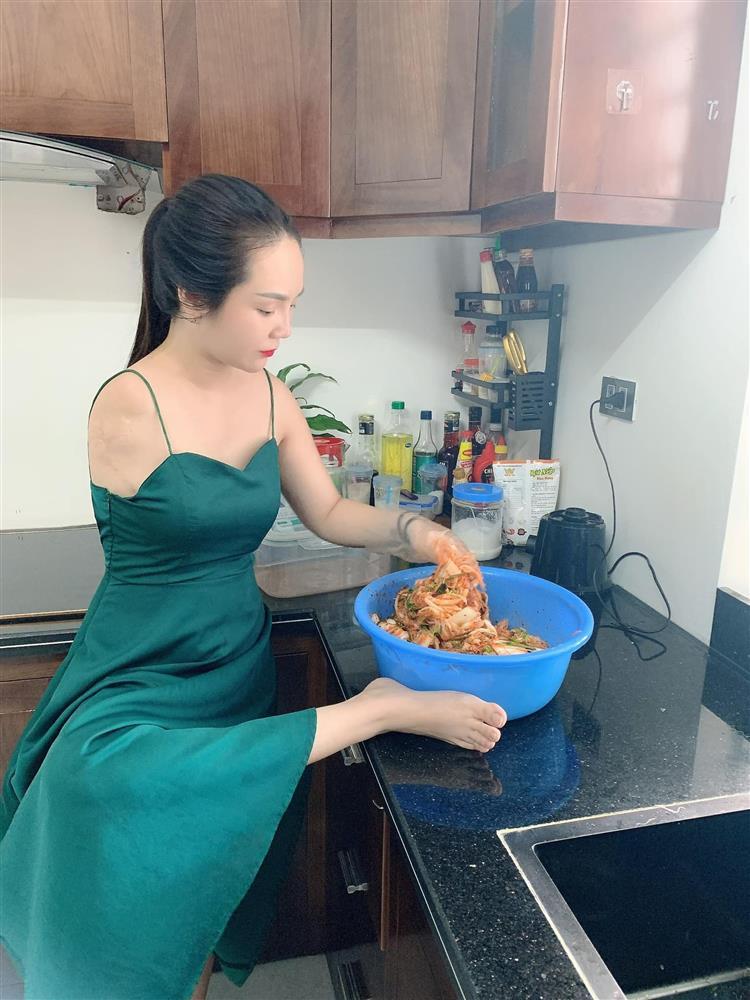 Gặp sự cố bất ngờ, cô gái một tay xinh đẹp ở Hà Nội tìm được chồng như ý-6