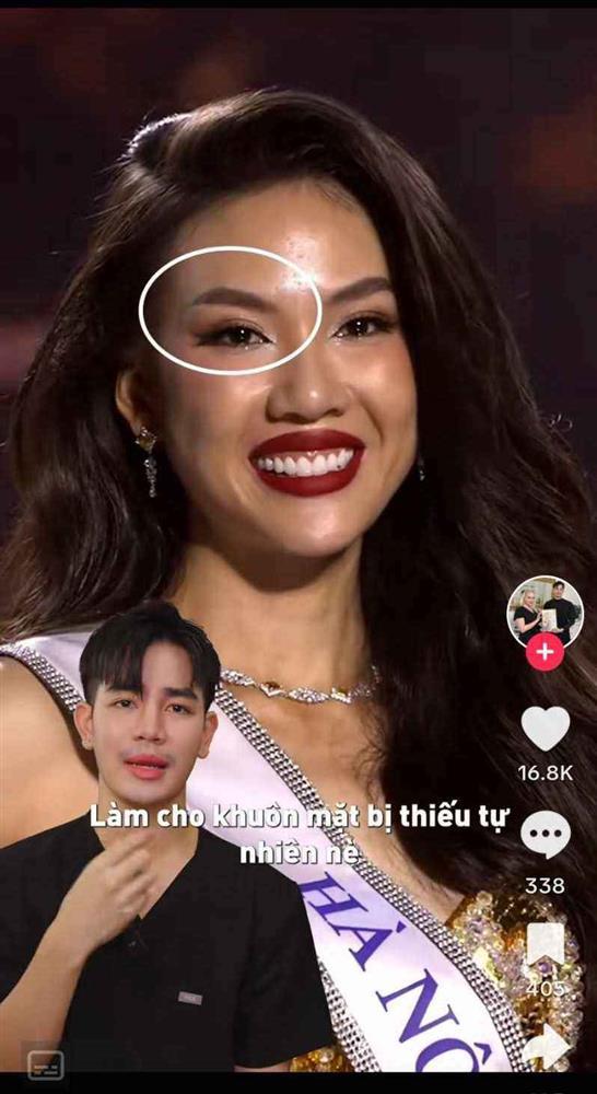 Chuyên gia nội khoa nghi ngờ Bùi Quỳnh Hoa căng chỉ mắt, tiêm filler để thi hoa hậu-1