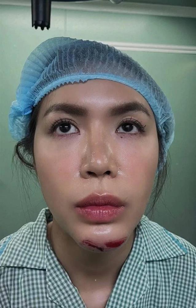 Sao Việt gặp sự cố khi quay show thực tế: Nhẹ thì gãy hai xương sườn, có người phải bỏ ngang-5