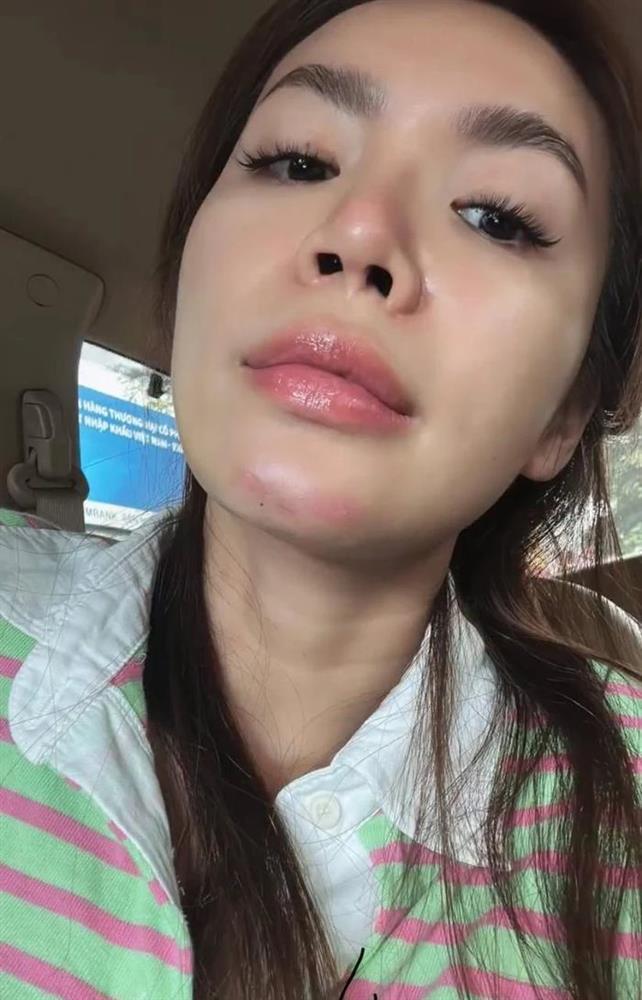 Sao Việt gặp sự cố khi quay show thực tế: Nhẹ thì gãy hai xương sườn, có người phải bỏ ngang-6