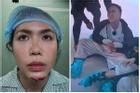 Sao Việt gặp sự cố khi quay show thực tế: 'Nhẹ' thì gãy hai xương sườn, có người phải bỏ ngang