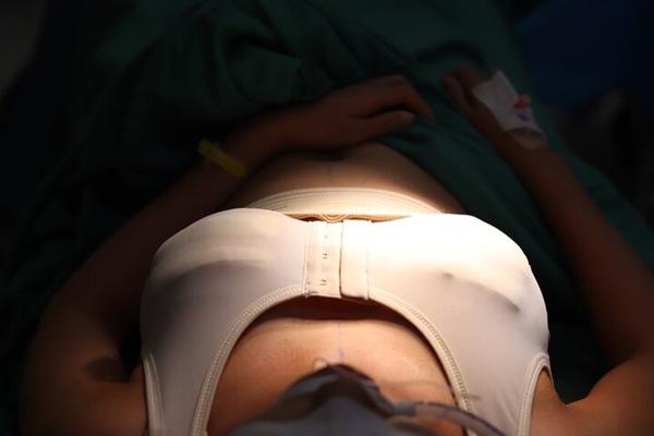 Ung thư vú ở tuổi 52, nữ diễn viên hối hận vì nâng ngực ở tuổi 18-6