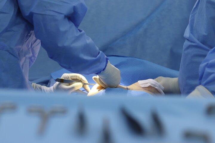 Nâng ngực bị sẹo, nguyên nhân do đâu?-4