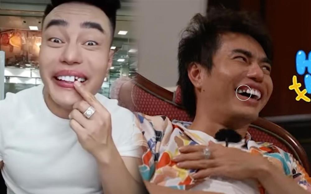 Game show gây cười bằng việc Lê Dương Bảo Lâm rơi răng sứ, cắn vào vai Thúy Ngân-2
