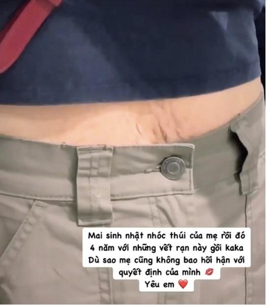 Hòa Minzy zoom cận những vết rạn bụng, nói gì về việc âm thầm sinh con 4 năm trước?-2