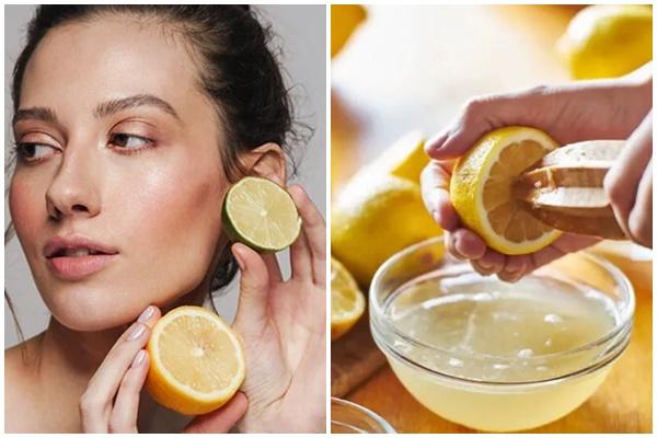 Chanh có làm giảm mụn trứng cá và sẹo?-1