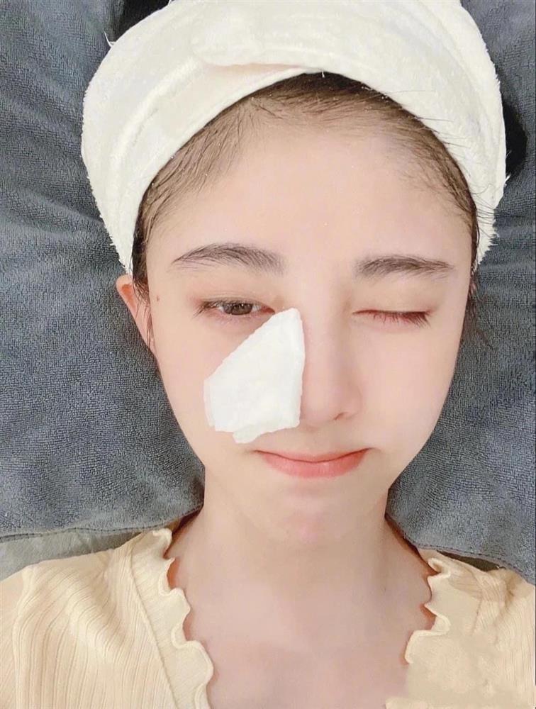 Làn da đẹp 10 điểm không có nhưng của Cúc Tịnh Y-3