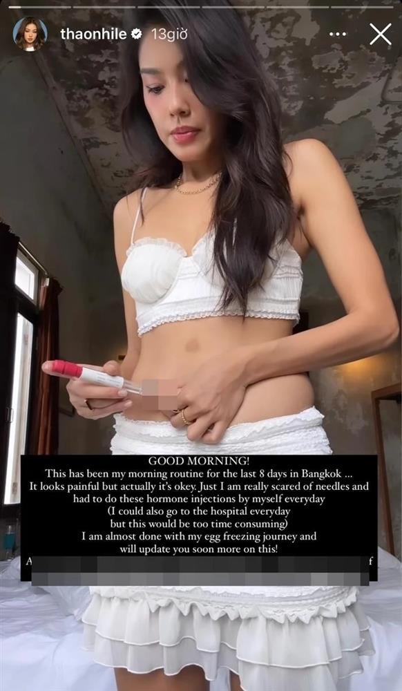 Á hậu Thảo Nhi Lê hé lộ quá trình trữ đông trứng-3