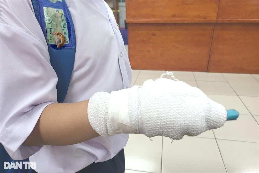 Nghi giáo viên đánh gãy ngón tay học sinh, lãnh đạo trường họp khẩn-1