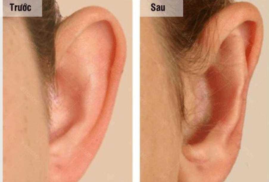 Huyền Baby sở hữu điểm tài lộc trên mặt, nhiều người phải dao kéo bắt chước-5