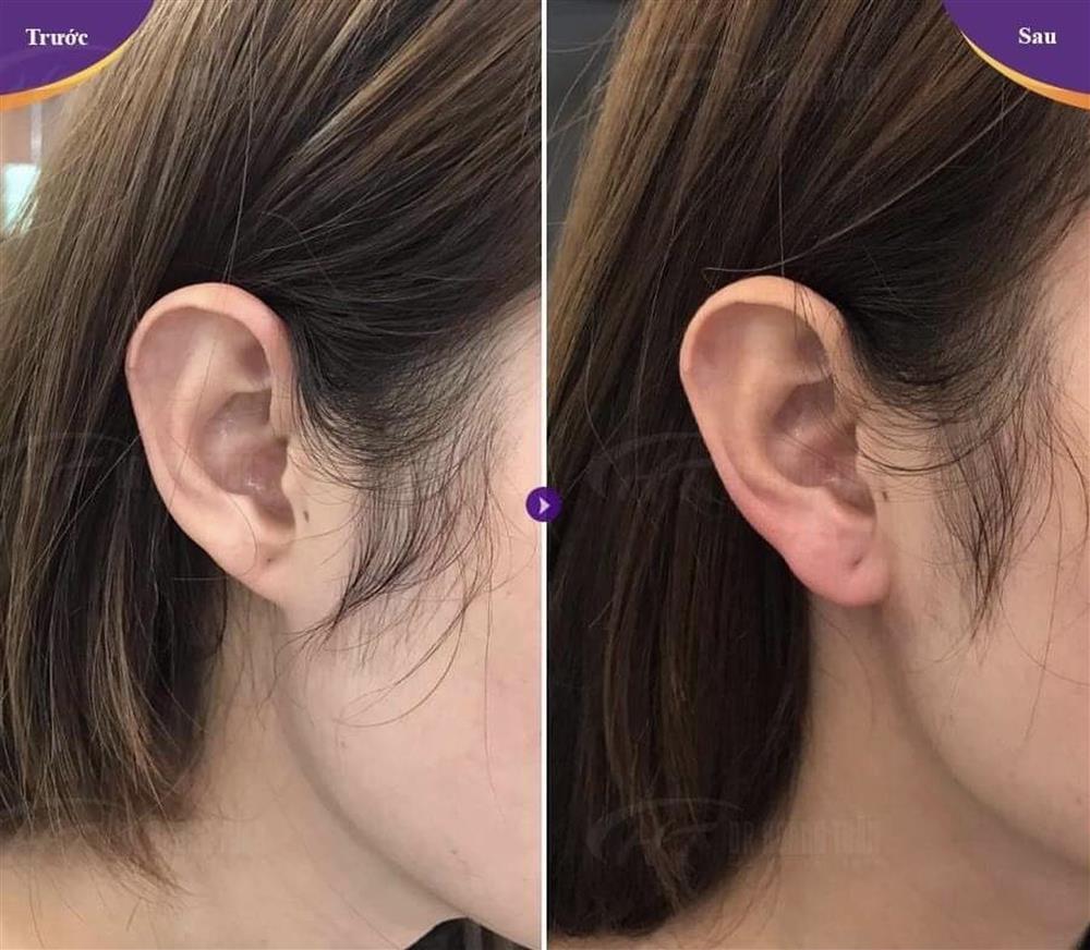 Huyền Baby sở hữu điểm tài lộc trên mặt, nhiều người phải dao kéo bắt chước-6