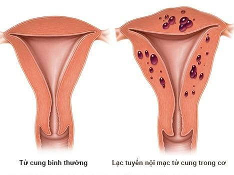 Bệnh khó nói: Cứ gần gũi chồng là đau-3