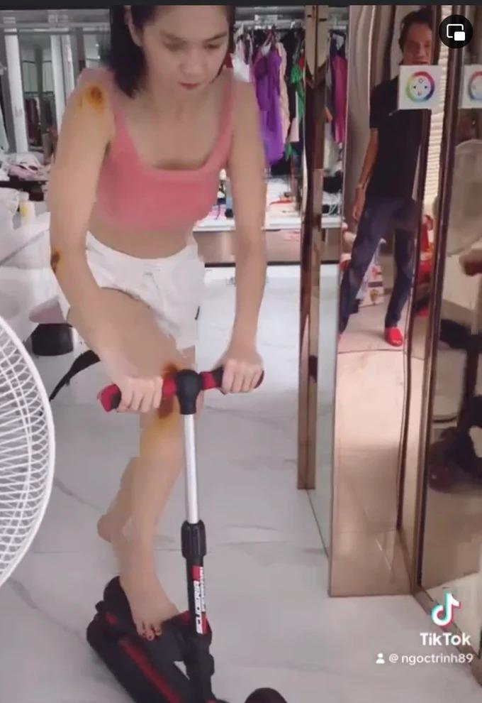 Ngọc Trinh công khai những vết xây xát khắp người sau khi ngã moto-3