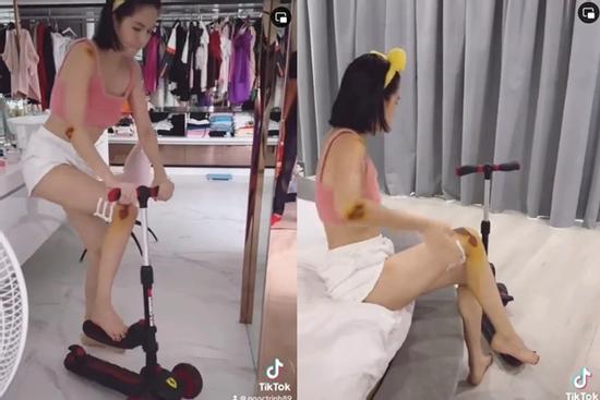 Ngọc Trinh công khai những vết xây xát khắp người sau khi ngã moto