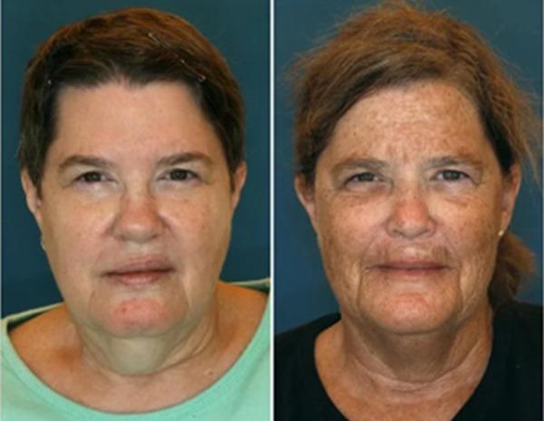 Cặp chị em sinh đôi nhưng ngoại hình như cách nhau 10 tuổi vì 2 thói quen-1