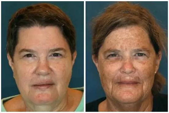 Cặp chị em sinh đôi nhưng ngoại hình như cách nhau 10 tuổi vì 2 thói quen