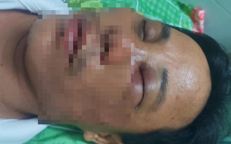 Bình Thuận chỉ đạo điều tra vụ thầy hiệu phó bị đánh nhập viện-1