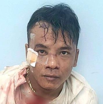 Bắt đối tượng từ TP.HCM về Long An cướp giật dây chuyền vàng-1