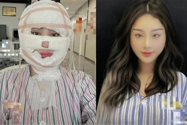 Chi gần 1 tỷ đồng để trùng tu nhan sắc, Lâm Khánh Chi quyết tâm trở thành đệ nhất mỹ nhân chuyển giới Việt-1