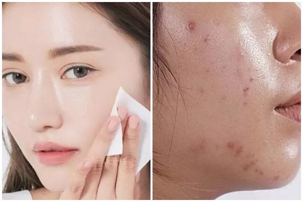 Ánh nắng lúc 7h có làm đen da?-5