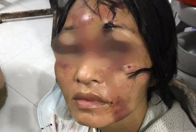 Bé gái 8 tuổi và người phụ nữ bị chồng hờ đánh đập tàn bạo-1