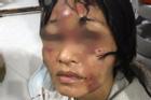 Bé gái 8 tuổi và người phụ nữ bị 'chồng hờ' đánh đập tàn bạo