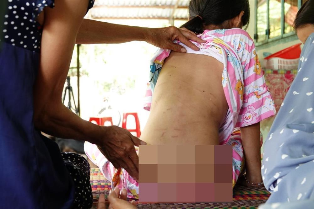 Bé gái 8 tuổi và người phụ nữ bị chồng hờ đánh đập tàn bạo-2