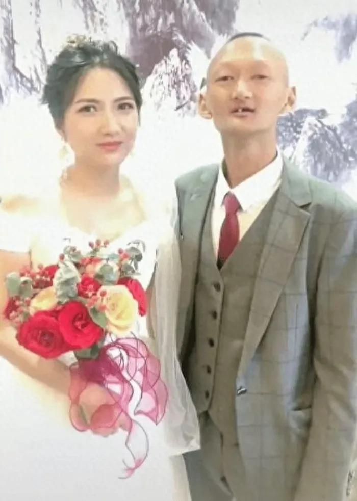 Chú rể xấu lạ cưới được cô dâu xinh như diễn viên-1