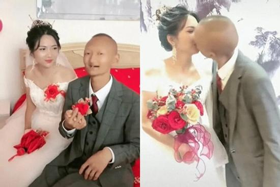 Chú rể 'xấu lạ' cưới được cô dâu xinh như diễn viên