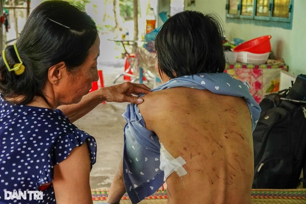 Những vụ chồng bạo hành vợ dã man ở miền Tây khiến dư luận phẫn nộ-3