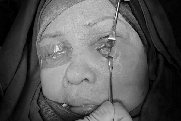 Tác dụng làm đẹp da của khoai tây ít ai biết-3