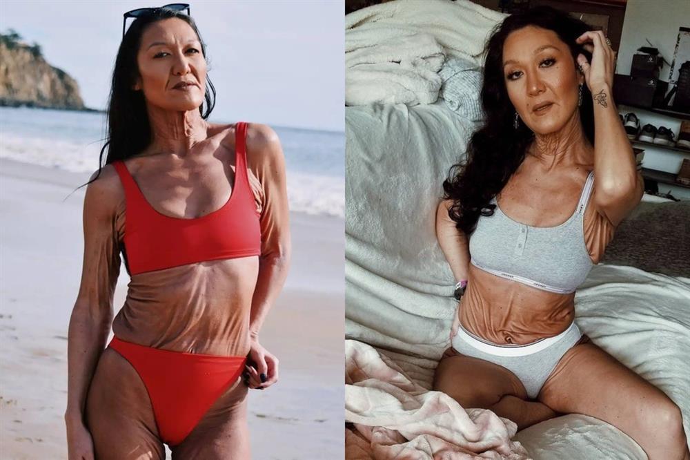 Có làn da nhăn nheo như cụ già, nữ người mẫu vẫn tự tin diện bikini-4