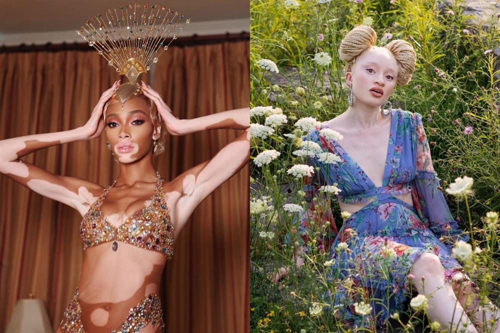 Có làn da nhăn nheo như cụ già, nữ người mẫu vẫn tự tin diện bikini-6