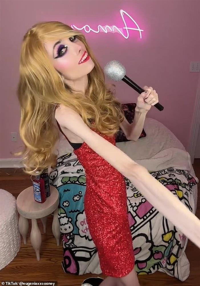 Cộng đồng mạng lo lắng cho ngôi sao mạng xã hội gầy như... bộ xương khô-1