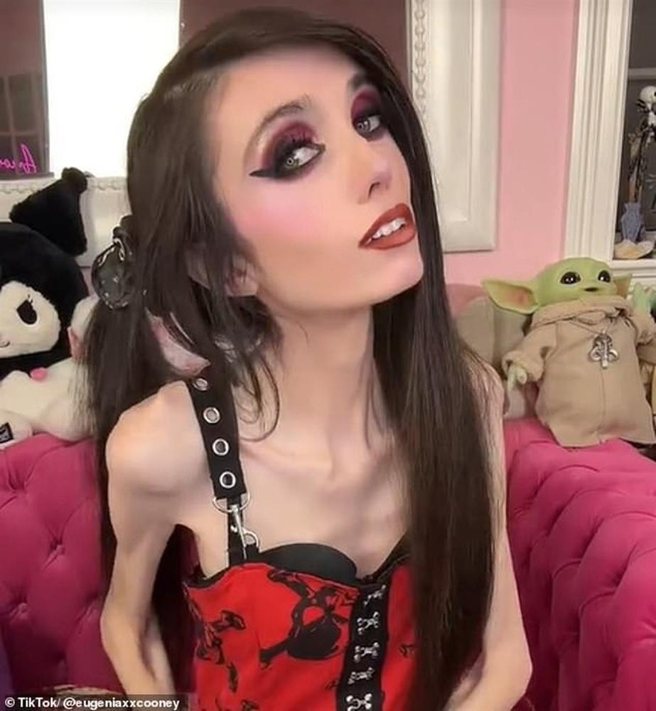 Cộng đồng mạng lo lắng cho ngôi sao mạng xã hội gầy như... bộ xương khô-2