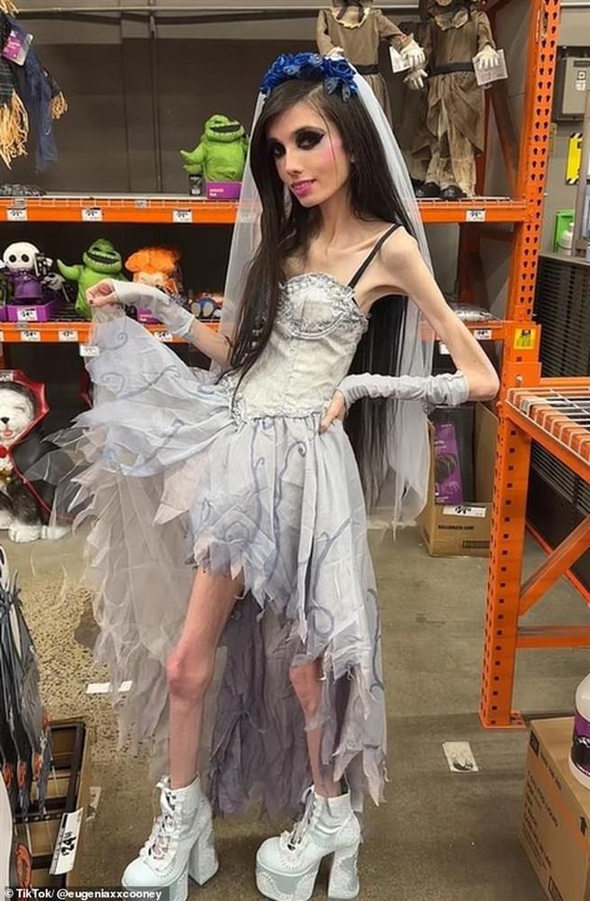 Cộng đồng mạng lo lắng cho ngôi sao mạng xã hội gầy như... bộ xương khô-4