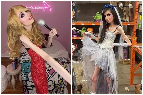 Cộng đồng mạng lo lắng cho ngôi sao mạng xã hội gầy như... bộ xương khô