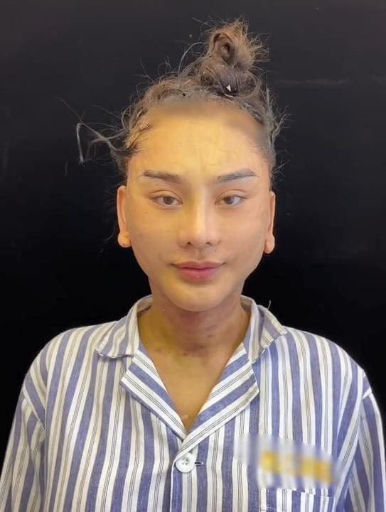 Hậu chi 1 tỷ căng da mặt, Lâm Khánh Chi phản ứng khi bị nói giống Quỳnh Búp Bê-6