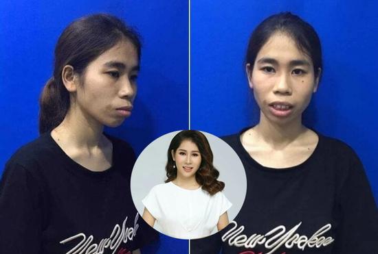 Cô gái Nghệ An bị gọi là 'khỉ đột' có màn lột xác ngoạn mục, mẹ ruột không nhận ra