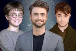 Động thái đã cho thấy phái nam chủ yếu 'Harry Potter' vừa vặn phong phú vừa vặn nhiều tình nghĩa