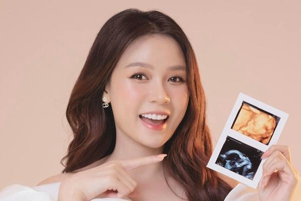 Sam chia sẻ về hành trình mang thai gian nan, ốm nghén nặng-3