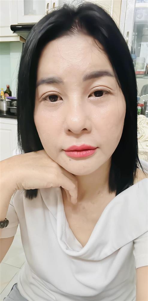 Tình hình sức khỏe của Cát Phượng sau khi nhập viện-2