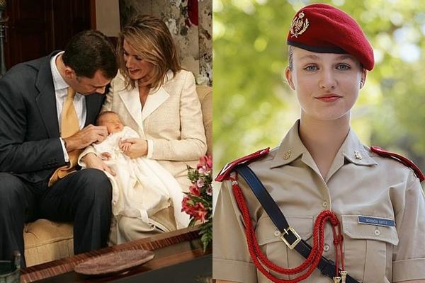 Hành trình duỗi thẳng lưng cho chàng trai có cột sống cong hình chữ Z-5