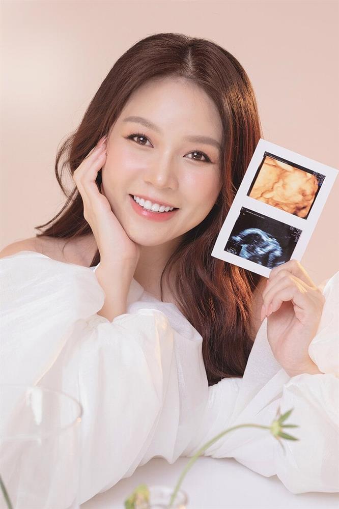 Sam chia sẻ về hành trình mang thai gian nan, ốm nghén nặng-1