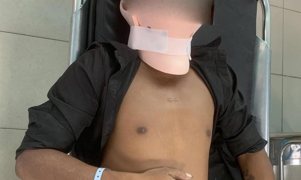 Vụ tai nạn 3 người tử vong ở Đồng Nai: Nạn nhân cấp cứu có nồng độ cồn cao-1