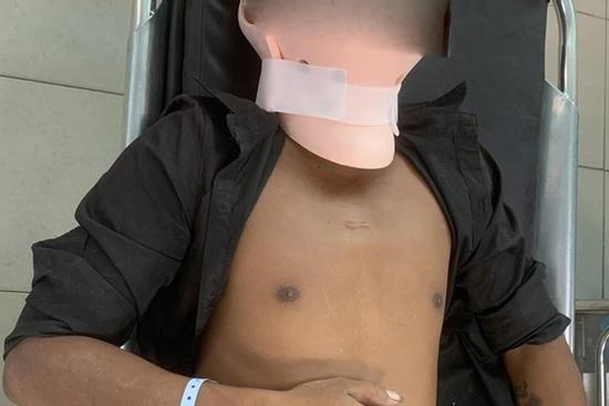 Vụ tai nạn 3 người tử vong ở Đồng Nai: Nạn nhân cấp cứu có nồng độ cồn cao