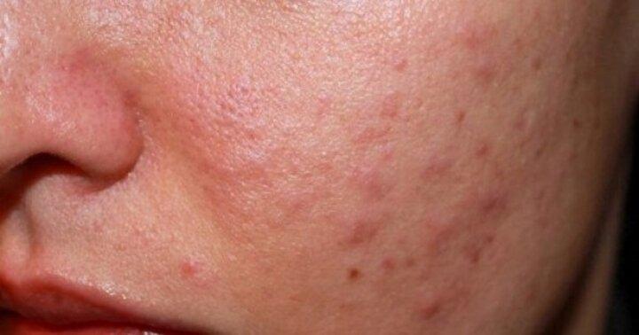 Những nguy cơ về sức khỏe khi mua mỹ phẩm trực tuyến-3