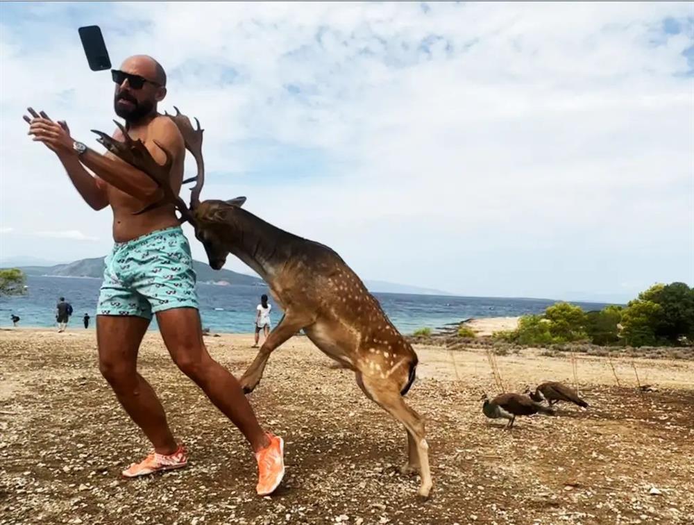 Du khách mải mê chụp ảnh bị nai sừng húc gãy xương sườn, suýt toạc lưng-2